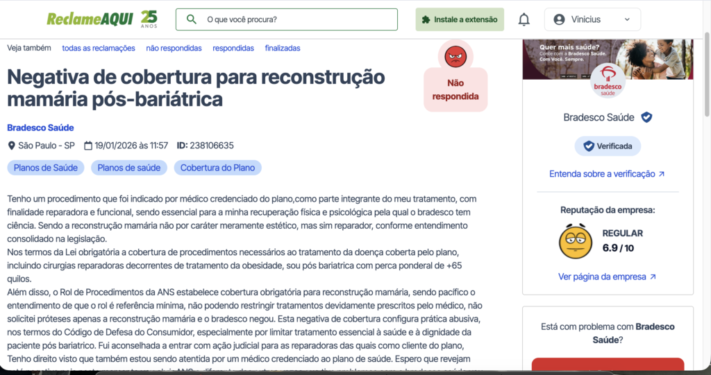 Reconstrução mamária pelo plano de saúde reclame aqui

