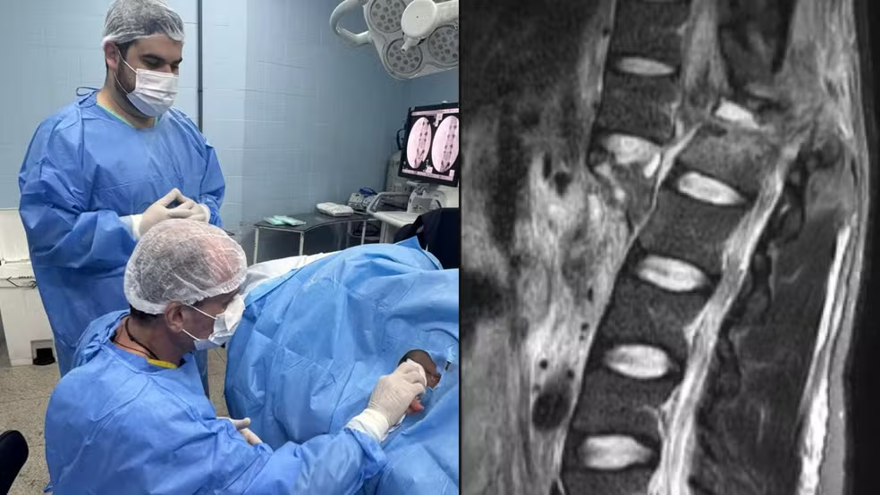 Polilaminina no Brasil: Os próximos passos da ANVISA à Incorporação no SUS pela CONITEC explicada por Advogado Especialista em Saúde